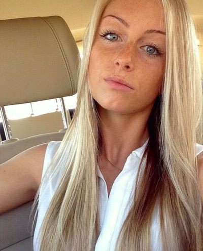 frecklesadmirer:Freckles Admirer