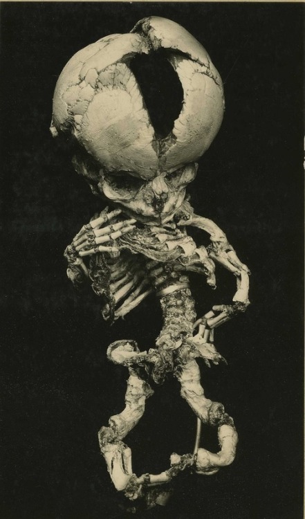 yubba1979:  Medical oddities 