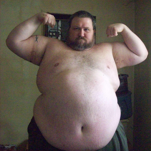 bigbubky:  Had a request for pics from when I was at my heaviest, 520 pounds and