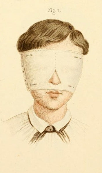 nemfrog:Fig. 1. Manual of surgical bandages, devices and dressings. 1859.