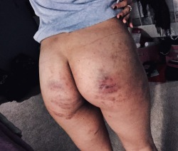 thelittleclosetfreak:  Daddy wasn’t happy with how little he bruised my bum last time he saw me so he made sure to hit me extra hard this time.   pleasedaddyyesdaddy