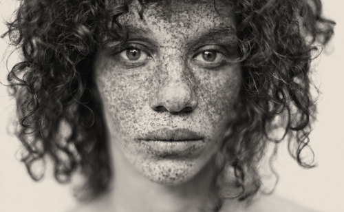 s0mmerspr0ssen:   For his recently published picture book Freckles (Splice Pictures Publishing), the Swiss photographer Reto Caduff has taken pictures of freckled women all over Europe. His pictures prove: freckles are beautiful. Don’t hide yourself