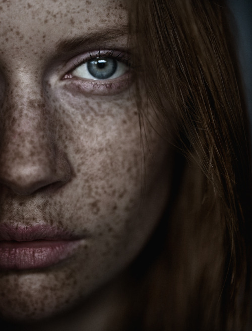 The Freckles Project on Behance by Carsten Witte