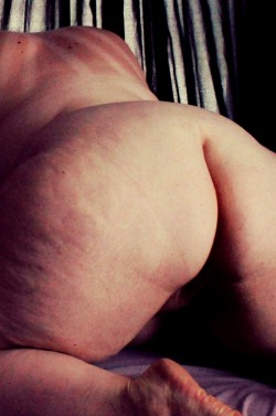 ox-miss-a:  Stretch marks & cellulite.