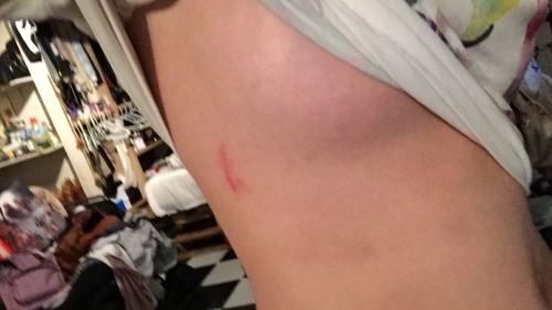 Forever jumping fences/walls/buildings/bushes drunk 🤖