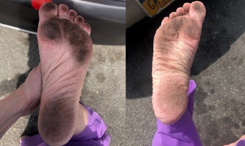 Dirty, calloused soles