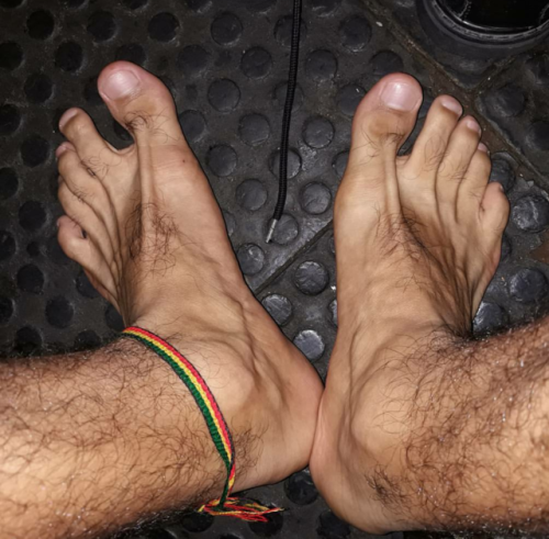 Hairy feet