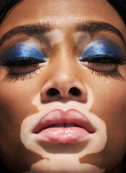 Porn Pics worldsmoda: Winnie Harlow for GRAZIA UK June