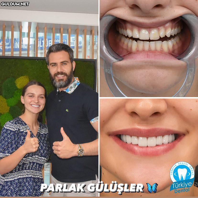 @turkeydental 👈...