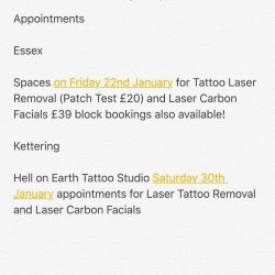 #lasertattooremoval #carbonfacial #laser