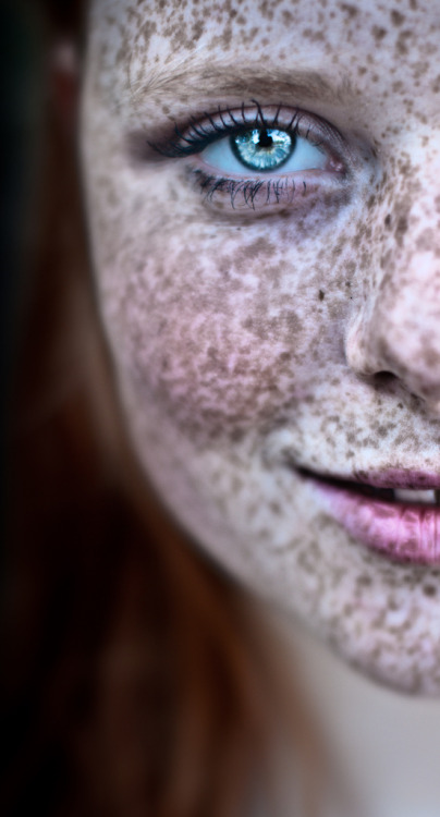 groteleur:  More girls with freckles >