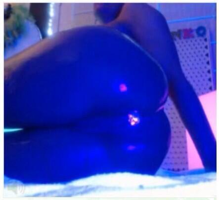 amateur-implant-pics:  Kerington Cruz 