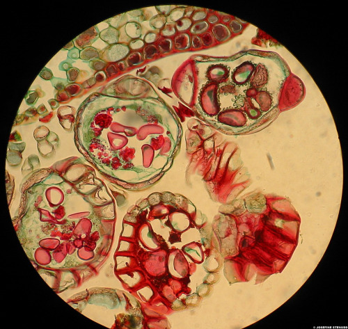 staceythinx:Micrographs by Josefine Stenddy 