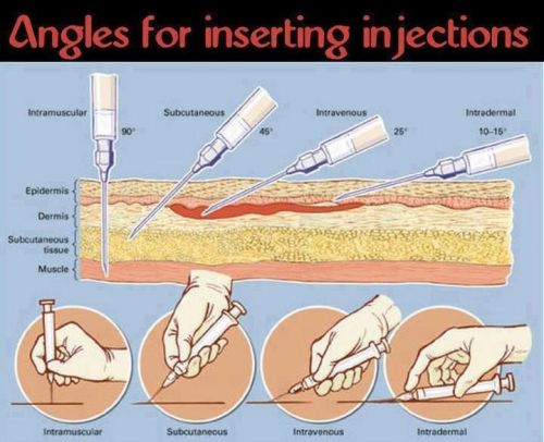 hedoescocaine:Proper angle to inject intravenously. Remember, when you think you are in a vein, pull