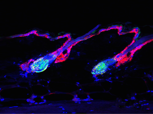 bpod-mrc:  Tightening Up Skin    Keratin is a key component of our skin, hair and nails, and more in-depth research has shown that it takes on other important roles in our cells. Scientists interrupted the normal occurrence of a keratin protein, Krt76,