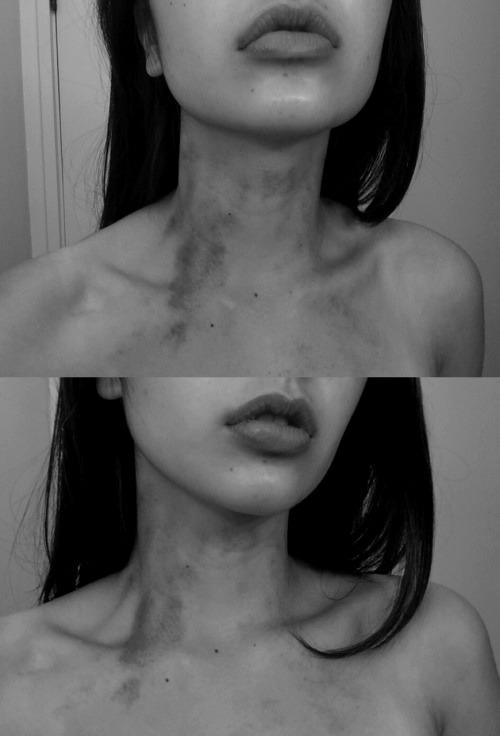 BROKEN HEART OF GOLD