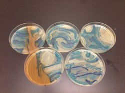 Huffingtonpost:  A Microbiologist Recreated ‘Starry Night’ With Bacteria In A