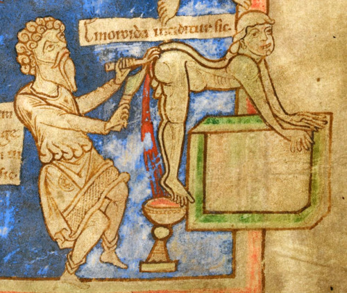 cutting the hemorrhoids &lsquo;emoroida inciditur sic&rsquo;Pseudo-Hippocrates, 'Epistu