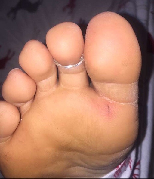 mew915:  Sexy ass toes!!