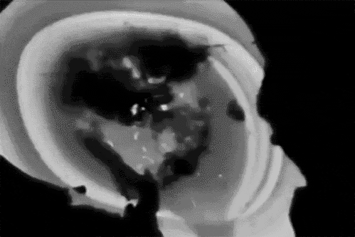 modddy:  X-ray of an insane mind.. 