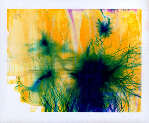 likeafieldmouse:  Phillip Stearns - Retinal Pigment Epithelium and Other Vision Technologi