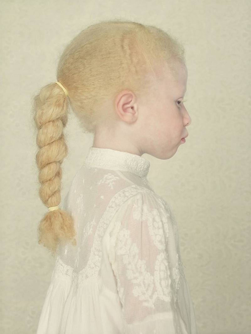 jareth-gates:  likeafieldmouse: Gustavo Lacerda - Albinos (2009-12) 