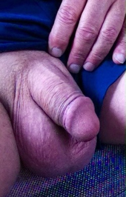 lettrius:  Jack from Melbourne Australia - Adult circumcision aged 40 (20 years ago).  Stunning cut cock