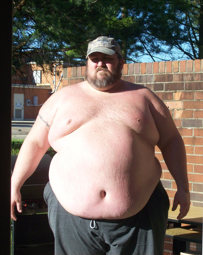 bigbubky:  Had a request for pics from when I was at my heaviest, 520 pounds and
