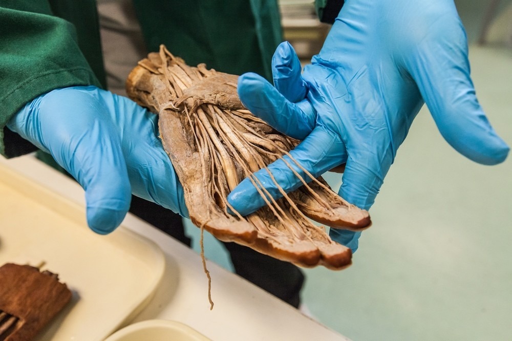 flyonthewallmedstudent:  forensicimagination:  (via What Happens When You Donate