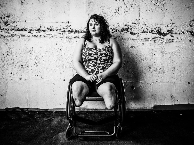npr:  It’s impolite to stare. But when it comes to severely injured soldiers, maybe