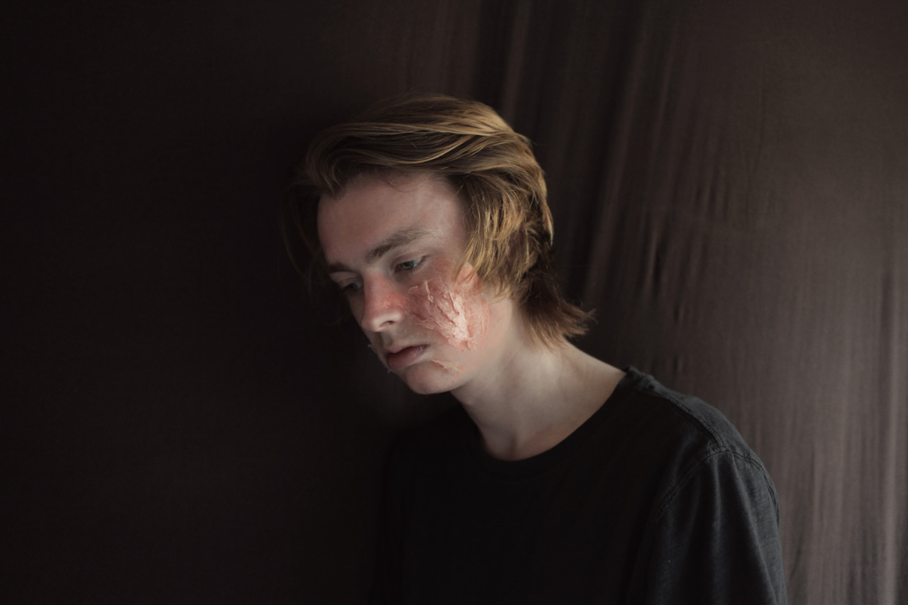 jacobrobertprice:  Singe (2014) - Jacob Robert PriceRecreating an accident that happened