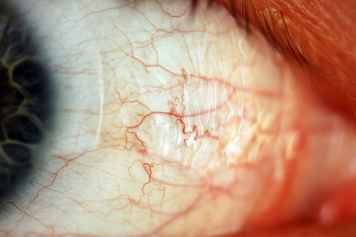 Blue Eye and Blood Vessels par Macroscopic SolutionsVia Flickr :Diffused light with: macroscopicso