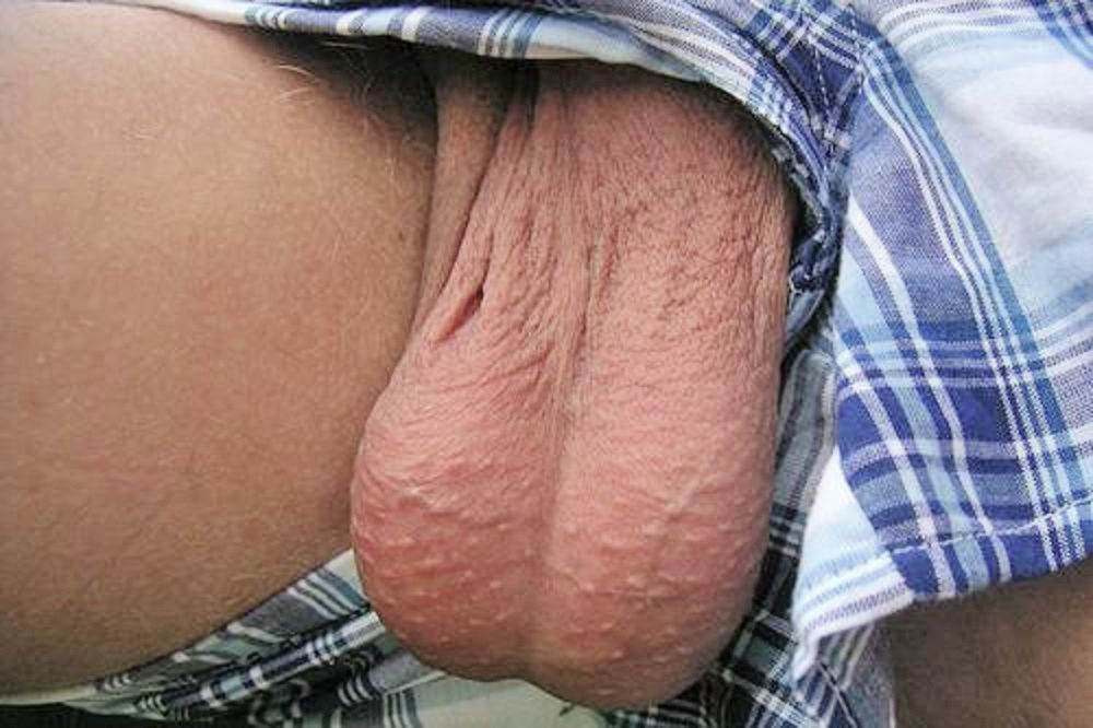 YUMMY&hellip;
