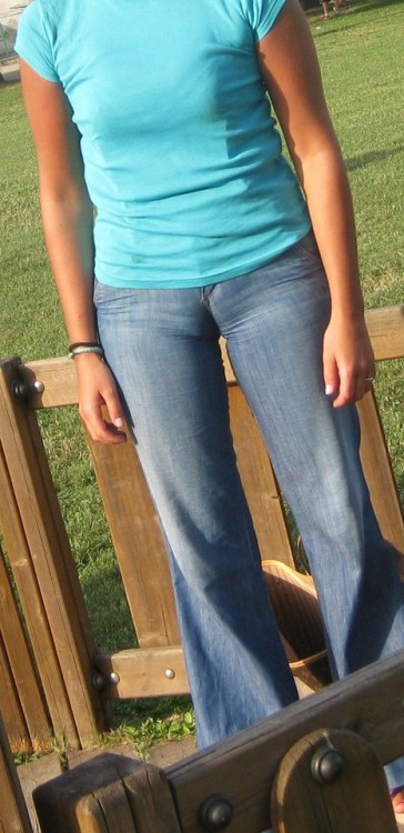 shinycameltoe: Public cameltoe at the park..