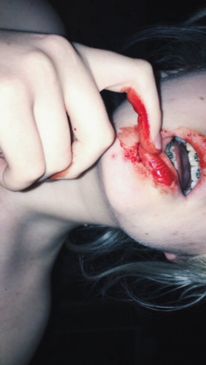 deranged-haematophiliac:anon submission be featured on my blog - send me your bloody pics