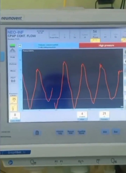Imagine Holding Your Child’s Hand While A Ventilator Breathes For Them, Knowing That Without Urgent