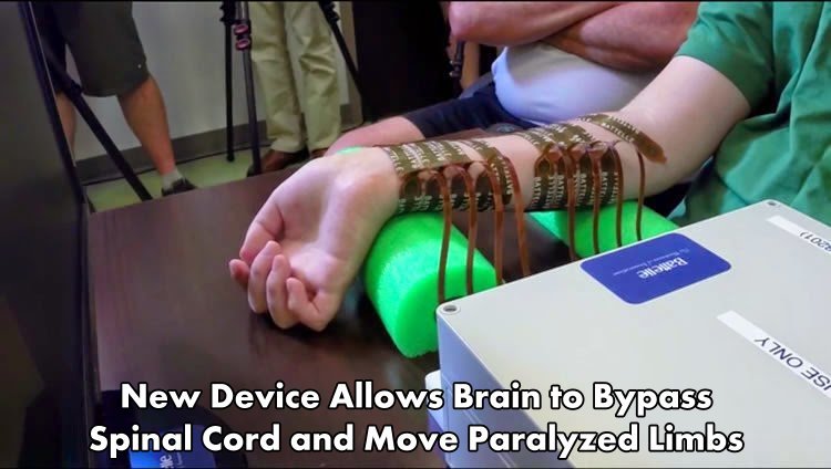 getoutofmyheadcharles:  historyofhyrule:  neurosciencenews:  New Device Allows Brain