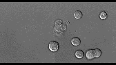 science-junkie:Human cell death captured using time-lapse microscopyScientists based at the La Trobe