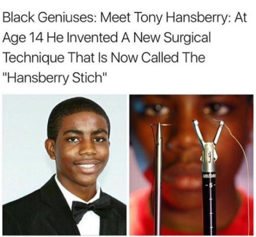 swagintherain:  21-year-old Tony Hansberry made history when he was only 14. He came up with a special technique to close wounds that is now used in gynecology. His method helped to complete the surgery three times faster and with fewer operations. He