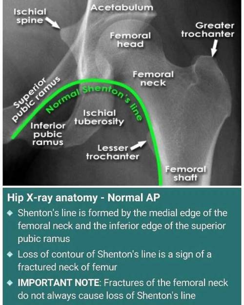 To detect abnormal, we should know the normal.!!#orthopedics #radiology #anatomy #mednotes #medstude