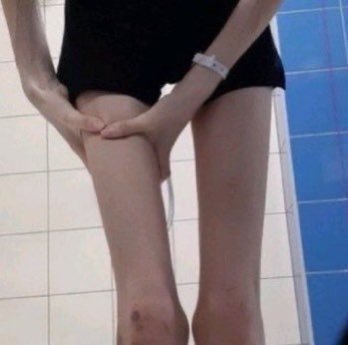 My Fav Thinspo/deathspo/bonespo Pics Atm