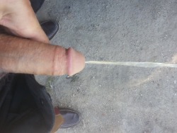 luvitcised:  cutcocklover:  This boy’s maintenance-free dick has no folds of skin to pull back or to wash under. Every once in a while, dad takes a quick look, sees the scar and exposed acorn head and is reminded of the day when he took the fateful