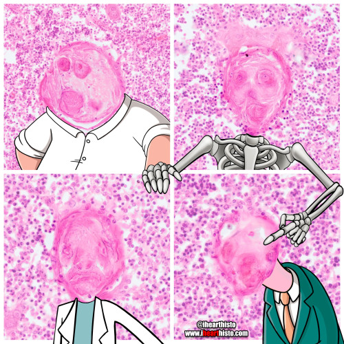 Meet the Hassalls The many faces of type VI thymic epithelial reticular cellsi❤️histoThe thymus is a