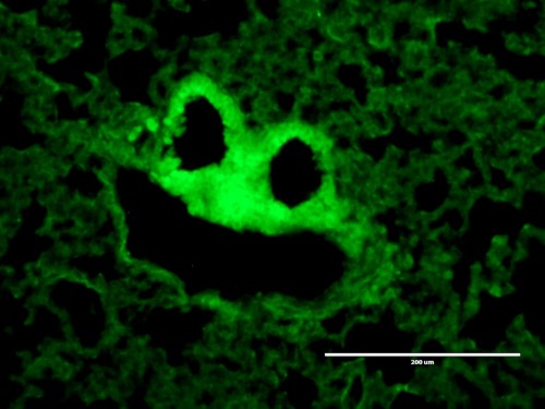 Spooky science This ghoulish image shows lung tissue structure.Laura Sibley who took this image is p