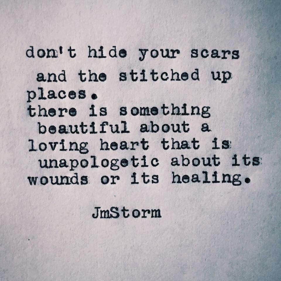 Note to self