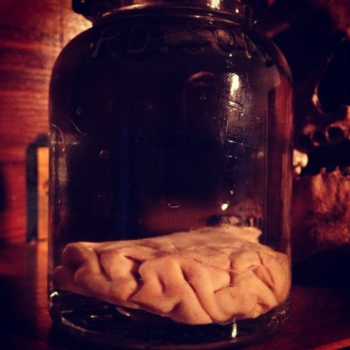 Brain section. #humanbrain#brainsection#wetspecimen#40s#medical#anatomy#poisonjar#globe#sweetthang#f