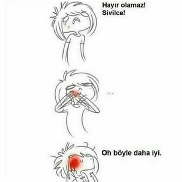 Hayır olamaz sivilce! Oh...