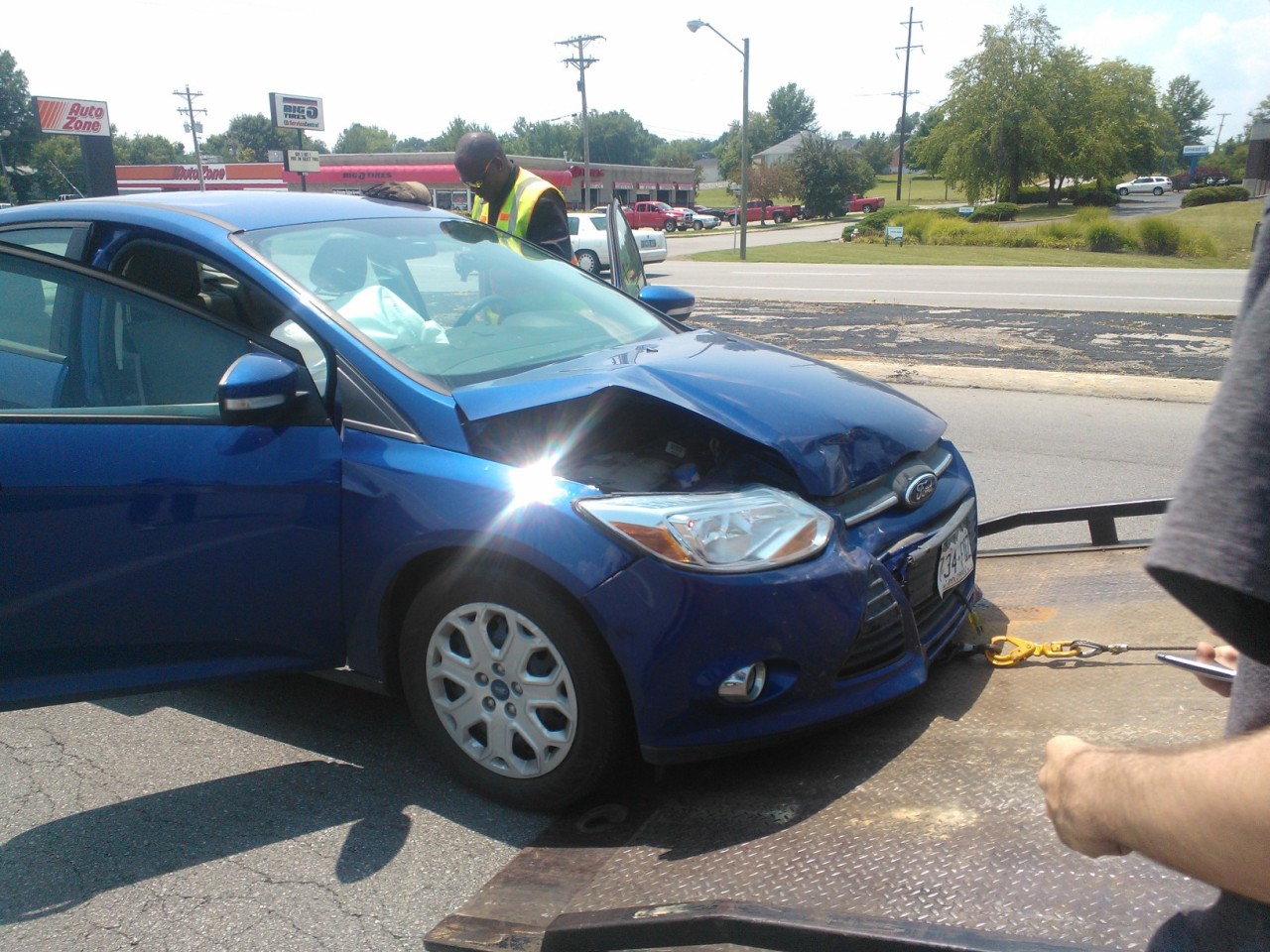 The car accident. You can see my airbag. I had pieces of the airbag stuck in my hair