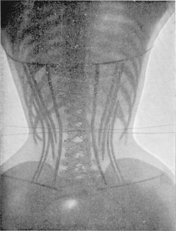 stfumadison:  X-Ray Image of a Corset, 1908 