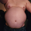 kronbelly